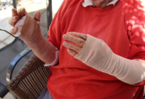 Dog attack victim speaks out