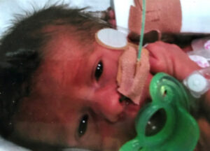 Vin has world at his feet after premature birth