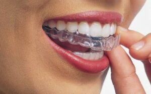 Orthodontics that will have you grinning from ear to ear