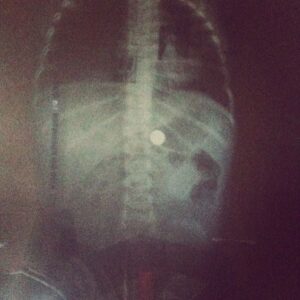 No toy is worth the risk