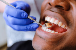 Preventing gum disease